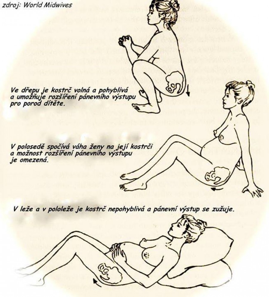 Ukázka průchodnosti porodních cest při různých porodních polohách